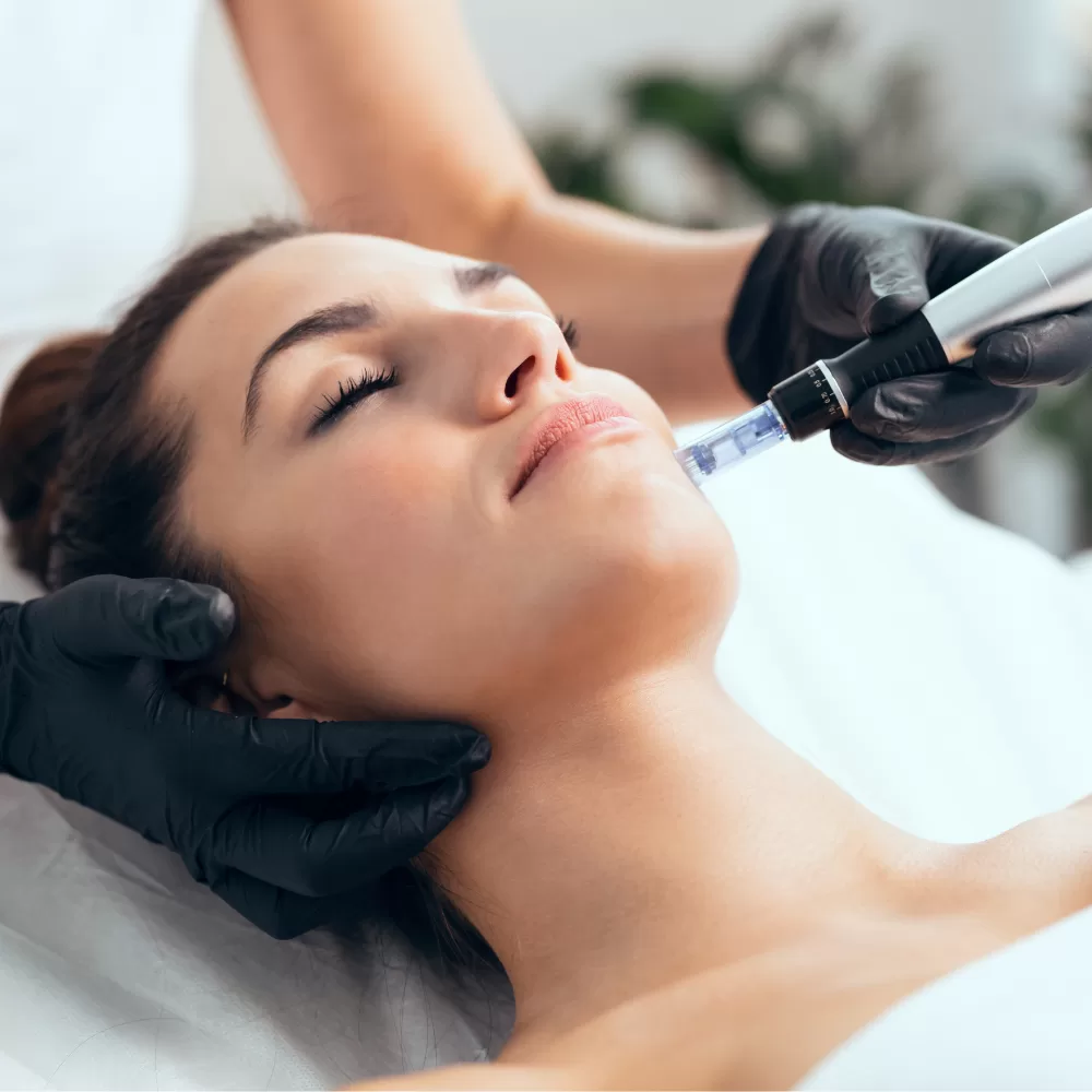 microneedling in Ruislip