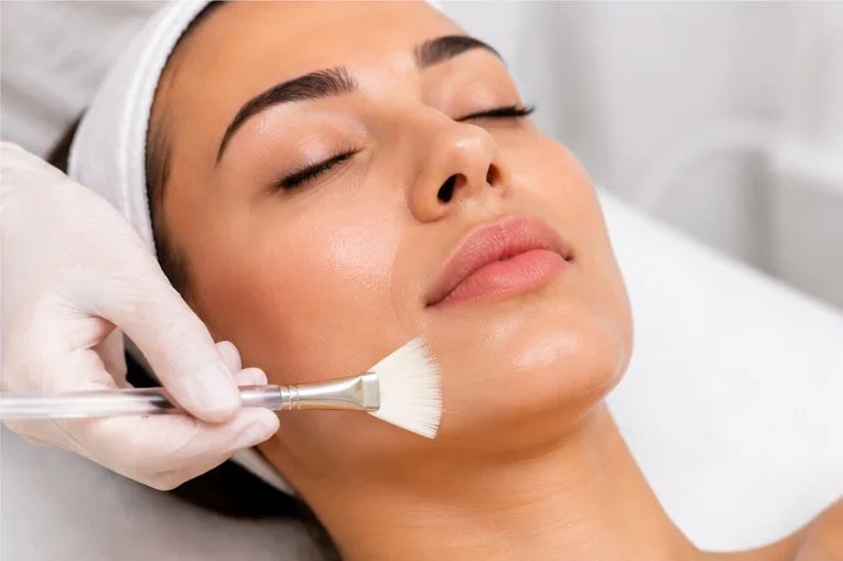 Chemical Peel in Ruislip